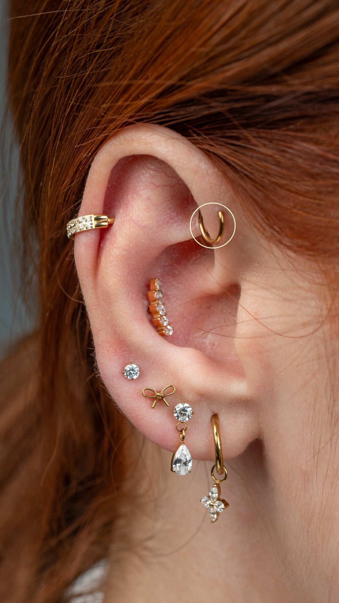 Fordward Helix-1